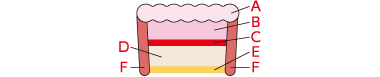 断面図
